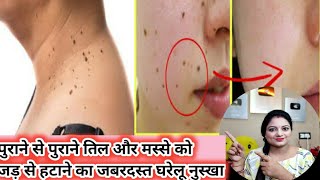 चेहरे के पुराने से पुराने तिल,मस्से को जड़ से खत्म करेंfairskin glowingskin glow skin whitening