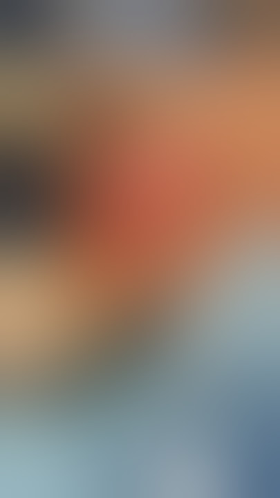 Breast Augmentation with a Lift / HPX 335 CCs / Part 1