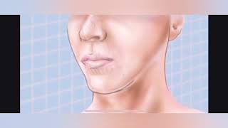 #inferior $alveolar  #nerve and nerve @#mylohyoid