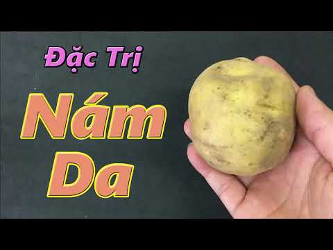 Cách trị nám da nhanh nhất và an toàn nhất tại nhà nhờ 1 củ khoai tây ( mẹo làm đẹp da )