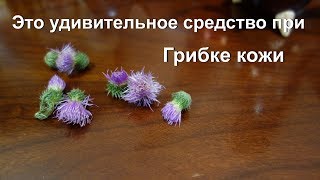 Это удивительный сорняк от грибка стопы. Микоз кожи ног. Вылечить грибок на ногах. Ай как просто? Это удивительный сорняк от грибка стопы. Микоз кожи ног. Вылечить грибок на ногах. Ай как просто?