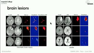 Deep Learning for MR Image Analysis - ISMRM 2018