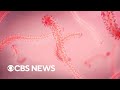 How health officials are responding to Congo Ebola outbreak
