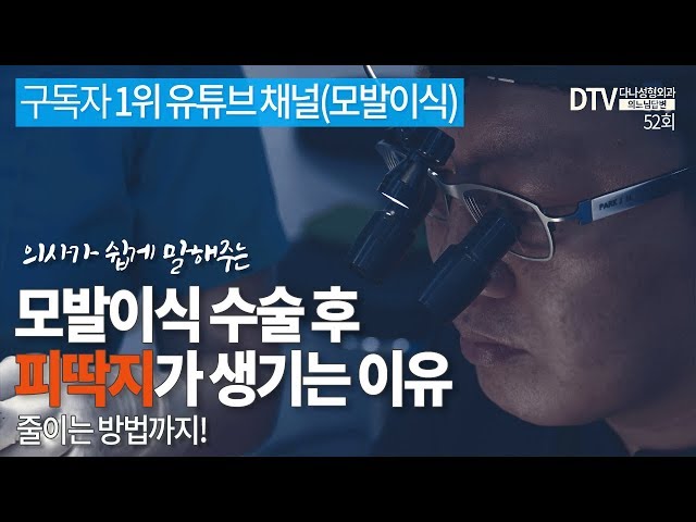 의느님답변📂ㅣ의느님 답변 52회 모발이식 수술 후 피딱지가 생기는 이유 : 출혈을 줄이는 노하우