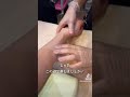 ベテランナースによるルートキープ講座 #恵聖会クリニック #美容外科#注射