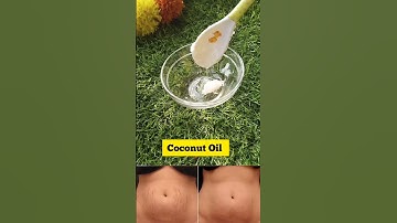 ✨Stretch Marks Removal At Home/How To Remove Stretch Marks#shorts#stretchmarks #stretch #viral#hack