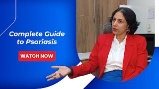 Psoriasis: Symptoms, Causes & Lifestyle Impact | Explained By Dr. Rinky Kapoor