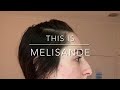 Melisande has a massive bimax double jaw surgery for gummy smile  custom titanium explained