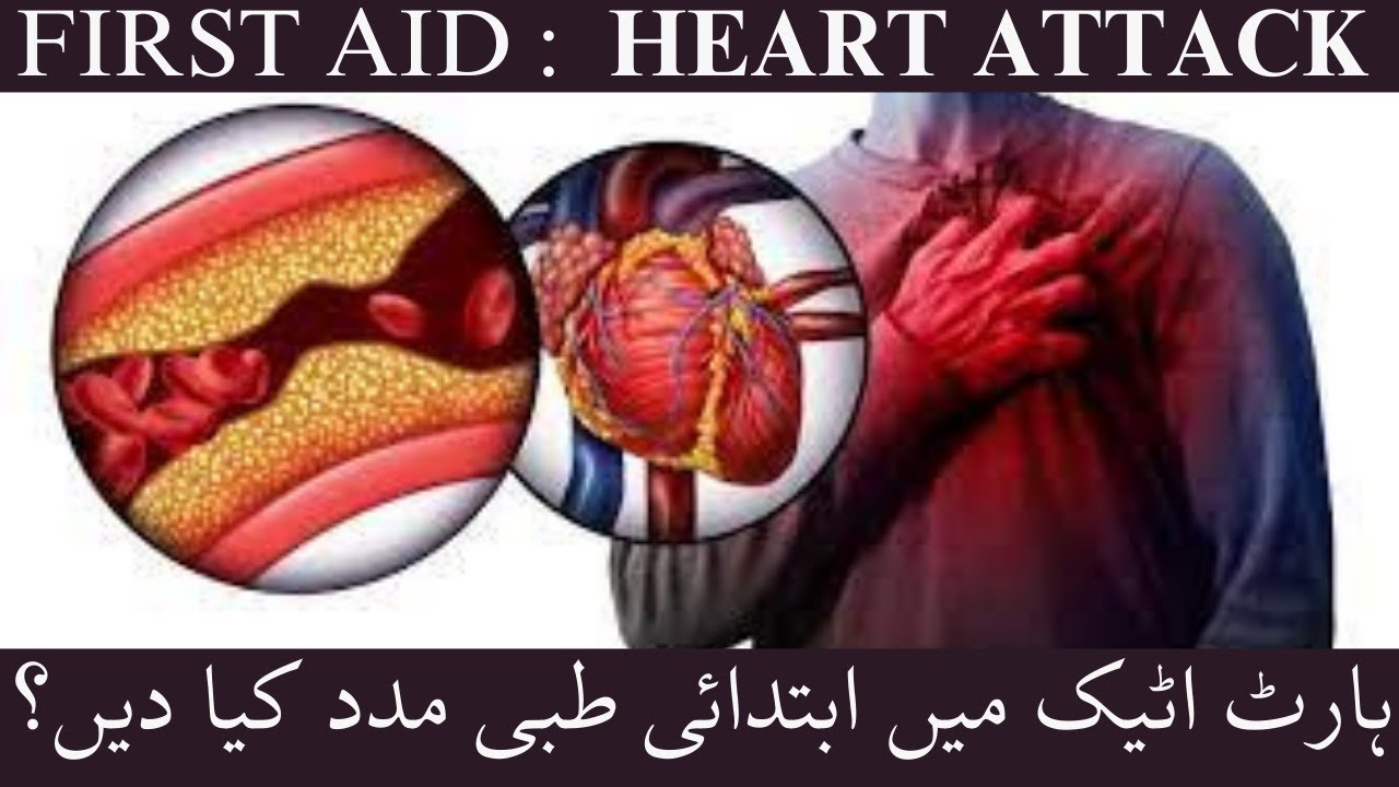 First Aid Heart Attack. Symptoms & causes and how to help a person
