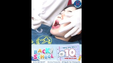 Răng có bị chạy lại sau khi tháo niềng không? | Bác sĩ giải đáp chi tiết