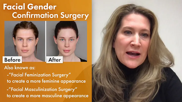 Facial Gender Confirmation SurgeryVideo Discussion...