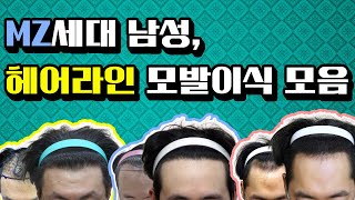 [비절개모발이식]MZ세대(20대) 남성 헤어라인 모발이식 전후사진 동영상 리얼후기 모음