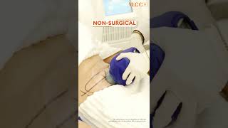 Coolsculpting 65% Off