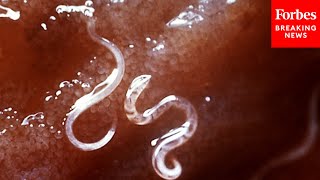 Live Worm Found In Woman’s Brain Is Rare—But Common Deadly Parasites Already Plague Billions