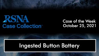 Case of the Week: Ingested Button Battery screenshot 5