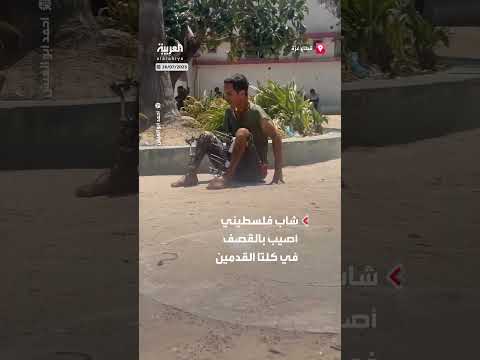 إصابة شاب فلسطيني في غزة تمنعه من الحركة