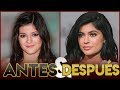 KYLIE JENNER | Transformación Antes y Después | CIRUGÍAS ESTÉTICAS