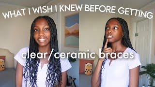 what i wish i knew before getting clear/ceramic braces