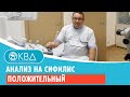 Анализ на сифилис положительный