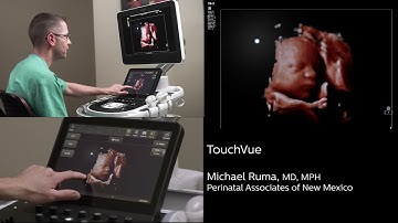 Philips TrueVue, TouchVue, MPR Touch, GlassVue, aReveal