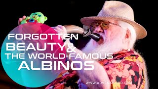 Forgotten Beauty Of The Worlds Famous Albinos