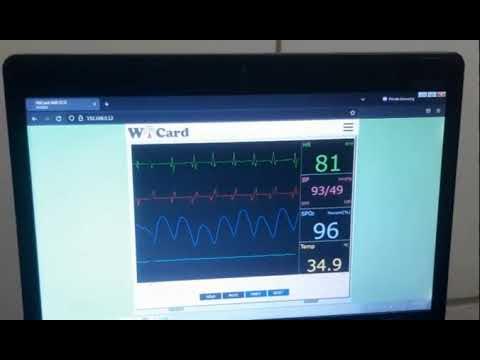 ESP8266 WiFi ECG, Testing on a real patient - YouTube