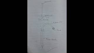 Estimation Of Haemoglobin Content For Blood Using Sahlis Haemoglobinometer