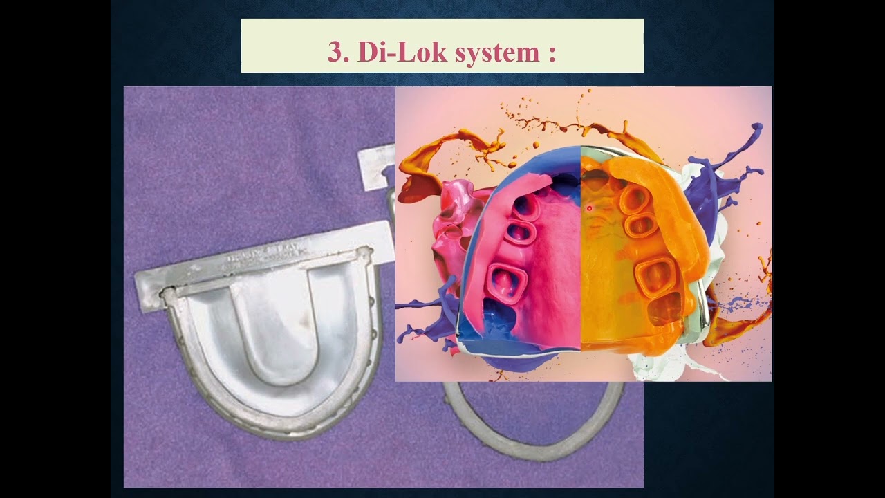 Di-Lok System Working Cast & dies صب المقاس للشغل
