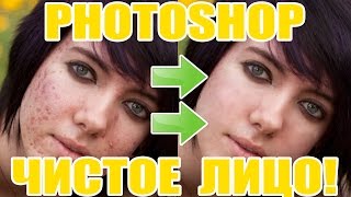 Как в фотошоп убрать прыщи Как в фотошоп убрать прыщи