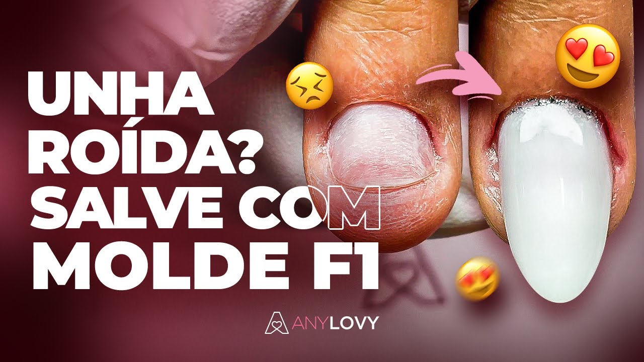 Unha Roida Unha roída Mayra Costa #unha #nails #nailart #dicavaliosa #manicure ...