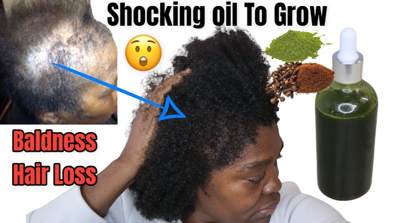 clove oil & moringa to accelerate hair growth at a rocket! edge & crown