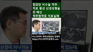 비수술척추치료 풍선신경성형술의 배신 척추관 협착증 디스크탈출증 비수술적추치료 양방향척추내시경김영우 척추신경외과 김영우 허리통증 목통증 목디스크  우리들병원연세사랑병원 #shorts