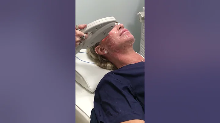 IPL Photofacial - What is Photofacial and IPL and What to Expect | Butterfly Medspa & Wellness | TX