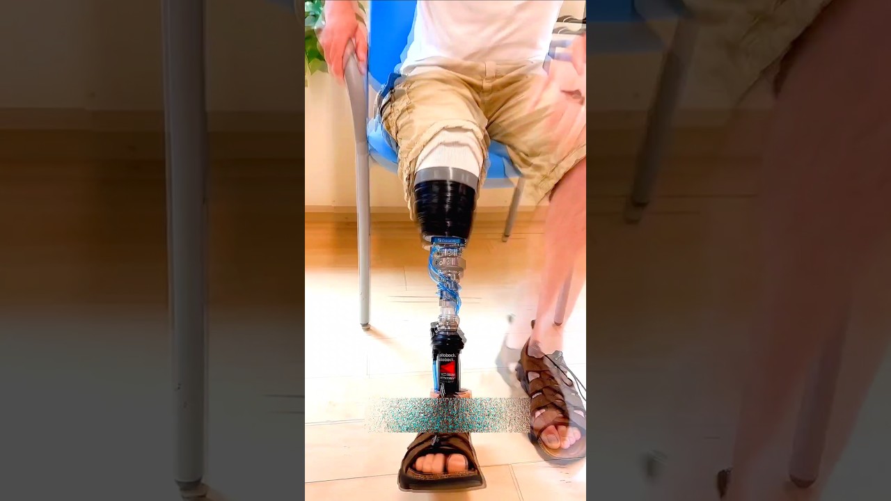 Carbon fiber Leg with in 30 minutes. - ThatwasDope 