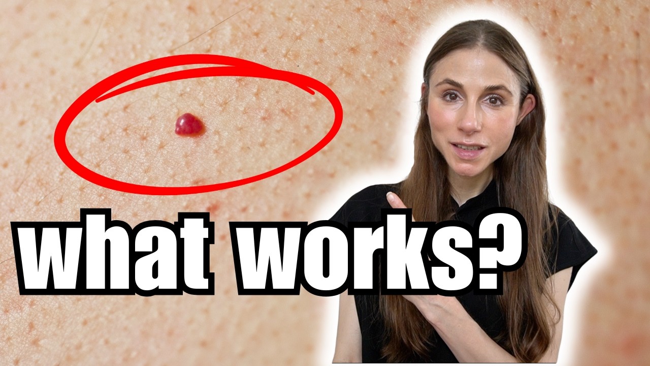 Cherry Angiomas, Sensitive Skin & Shaving Tips | Dermatologist Answers