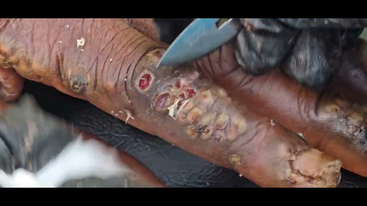 Robert Livingstone's jigger dig #2 - see long vids @ riseupsociety.net & ruskenya.org