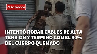 Intentó robar cables de alta tensión, se electrocutó y terminó con el 90% del cuerpo quemado