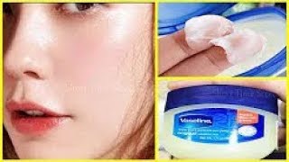 In 3 Days Remove Dark Spots, Black Spots With Vaseline Amazing Vaseline Benefits For Darkspots