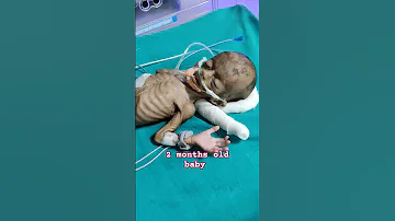 2 Months Old Baby Do This Lap With The Baby At Home Nicucare Viralshort Baby Nicu 