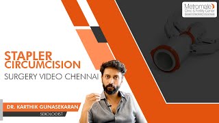 Stapler Circumcision surgery Video Chennai | Metromale Clinic \u0026 Fertility Center