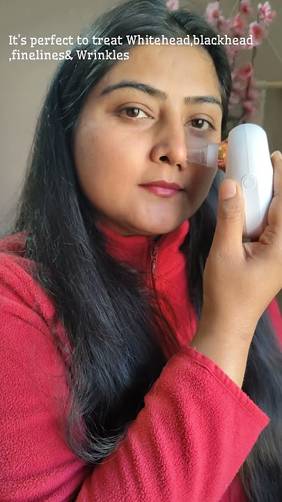 Blackhead,Whitehead remover from Winston|It works amazing| #shorts #ytshorts #viral #winston