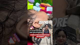 Baby Breathing Sound? Not Infection! ⚠️ | Laryngomalacia Explained | Dr Deepa Aggarwal