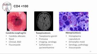 HIV: Clinical Disease and Opportunistic Infections