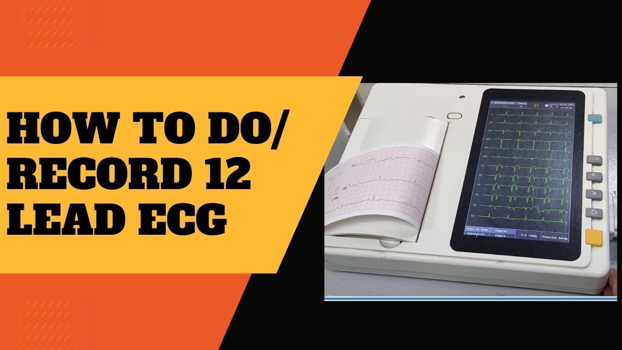 How to record an ECG How to perform a 12 lead ECG ECG kaise karty