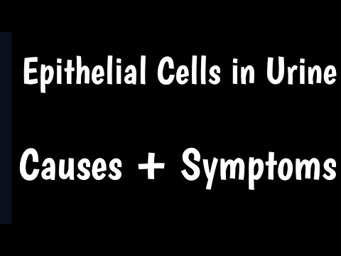 ভিডিও: স্কোয়ামাস এপিথেলিয়াল কোষ কি খারাপ?
