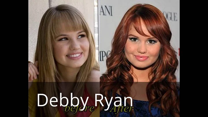 Suite life cast before and after