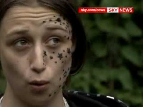 Face Tattoo Horror: Teenager Left Seeing Stars