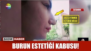 Burun Estetiği Kabusu