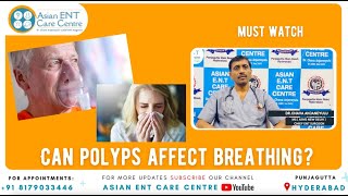NASAL POLYPS | Can NASAL POLYPS Affect Breathing ? |  Dr.Chava Anjaneyulu | Best ENT Specialist Hyd