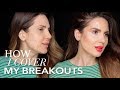 HOW TO COVER BREAKOUTS - NATURAL FINISH | ALI ANDREEA